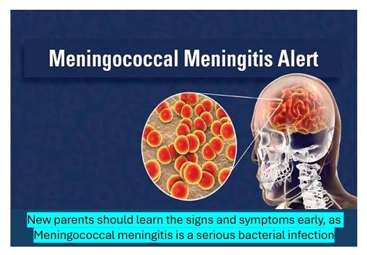 Meningococcal meningitis