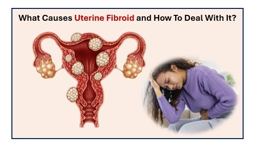 Uterine fibroid