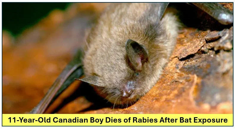 11-year-old canadian boy dies of rabies after bat exposure, doctors urge immediate treatment